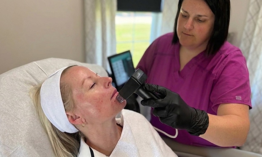 Image 3: Six Laser Hair-Removal Sessions for Area of Choice
