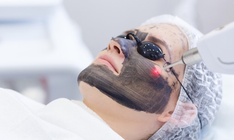 3 sesiones: Hollywood peeling con mascarilla de carbón activo y láser
