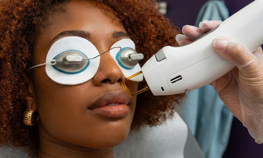 Image 2: Six Laser Hair Removal on Small, Medium, or Large Area, or Full Body