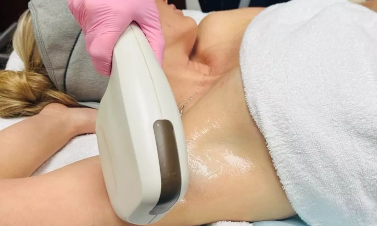 Laser Hair Removal on Small, Medium, Large, XL or Full Body Areas at Radiant Refine Medspa (Up to 55% Off) - Second Medium