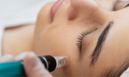 Sesión de microneedling de labios con relleno dérmico y exfoliación - Cris Falcão Beauty Pmu