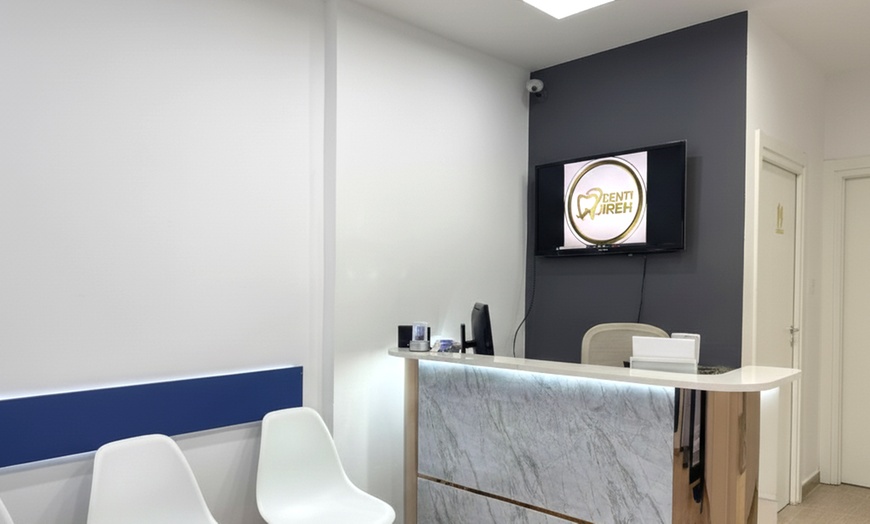 Image 2: Blanqueamiento dental LED con limpieza bucal y fluorización