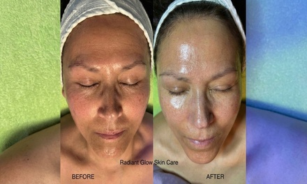 Supreme Hydrafacial - Cleanse, Extract, Sculpt/Contour, Customized Boosters, LED Red Light, Neck and Shoulder Massage - RadiantGlow