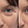 Image 4: Skin-Rejuvenating Fractional CO2 Laser Treatment for Wrinkles & Scars