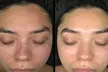Get Cica Rescue- Korean/ Radiant Cascade Facials, Sea Sponge Peels+ Facial (Up to 76% Off) - Second Medium