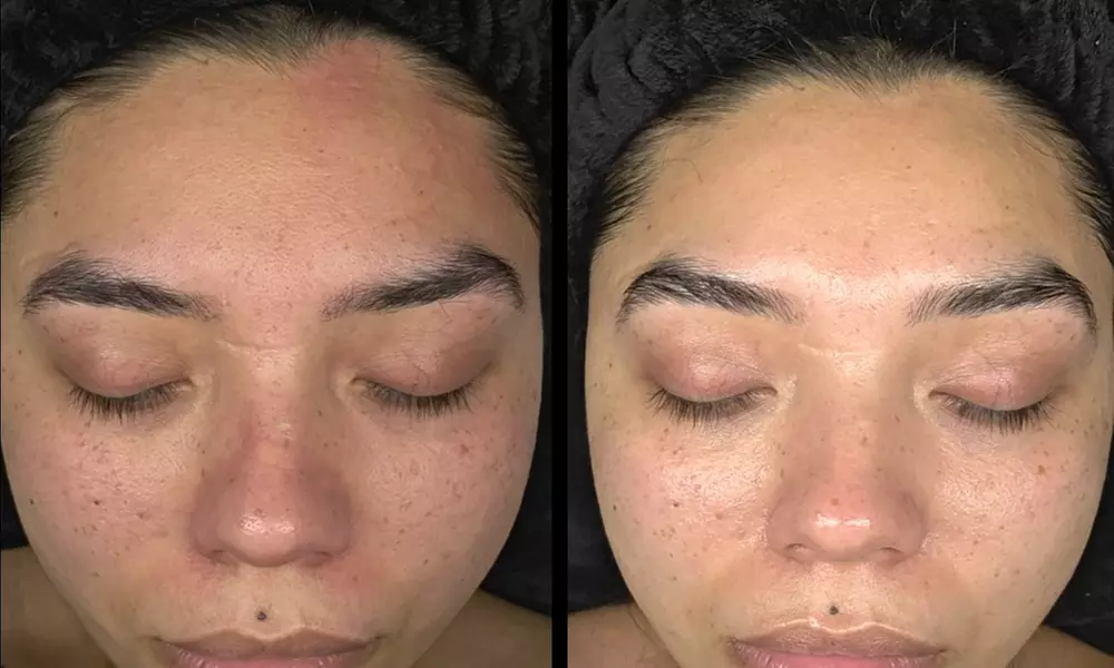 Cica Rescue- Korean/ Radiant Cascade Facials, Sea Sponge Peels+ Facial