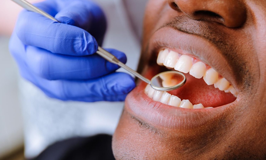 Image 6: Airflow Teeth Cleaning or Scale and Polish with Dental Consultation