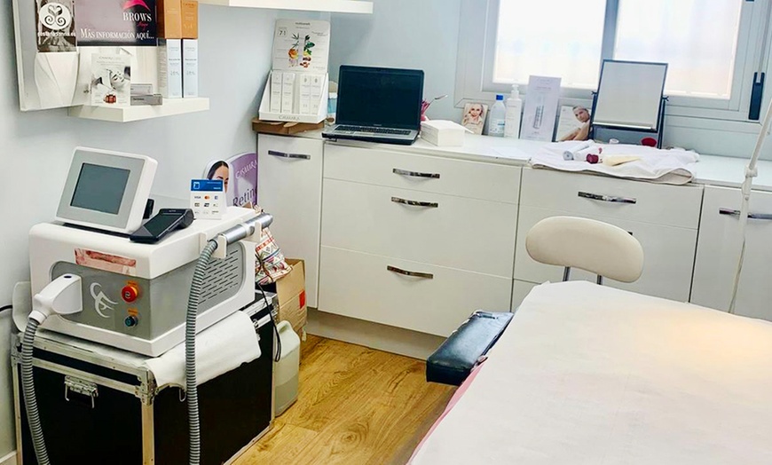 Image 4: Sesión de microneedling facial con Dermapen