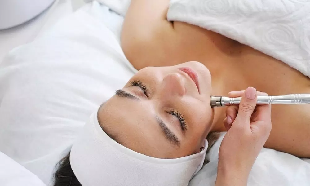 One Diamond Microdermabrasion Facial Treatment for Smooth, Refreshed Skin(Up to 33% Off)