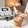Image 2: Radiant Skin Starts Here – Full Face Skin Needling at Aqua Laser Clinic Hurstville