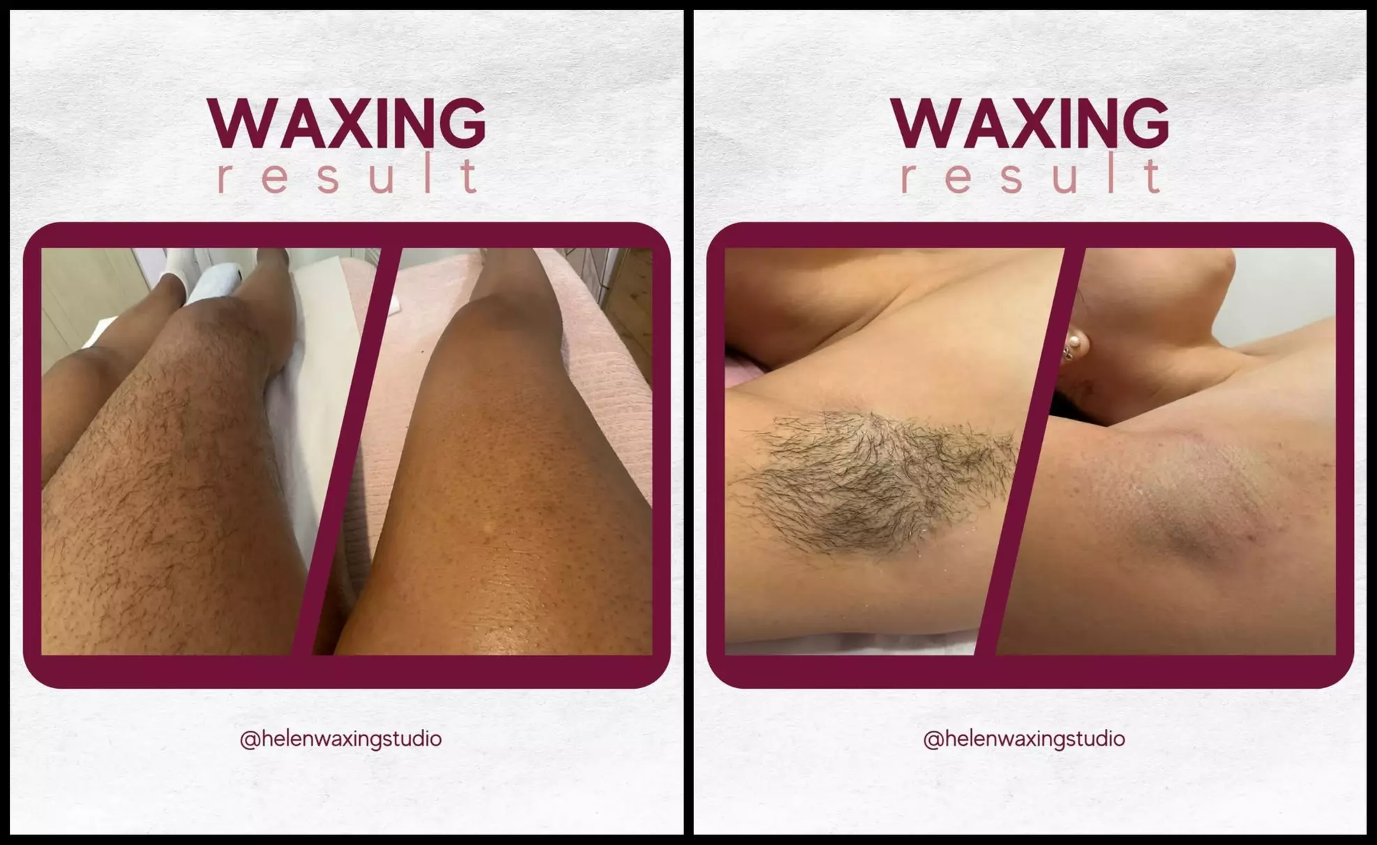 Expert Waxing From A Specialist! Legs, Brazilian/Hwood/Bikini & More