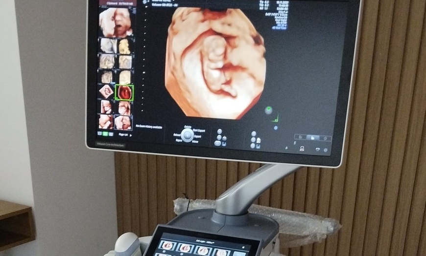 Image 3: Ecografía 5D para embarazada y opción a conocer el sexo del bebé 