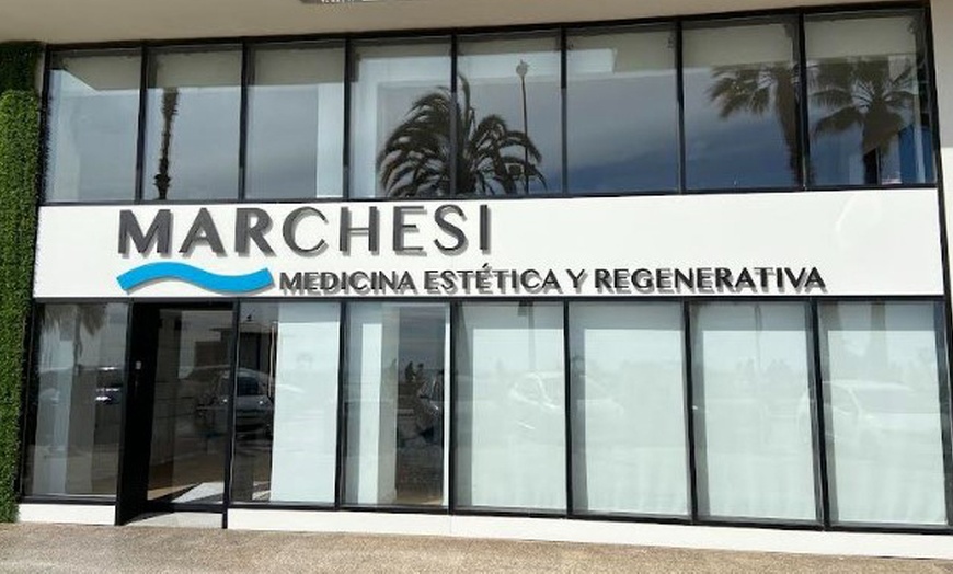 Image 4: Tratamiento facial antiedad con peeling, mesoterapia infiltrada y más