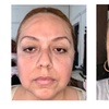 Image 4: Turn Back The Clock on Your Skin with 20, 40 or 60 Units of Xeomin
