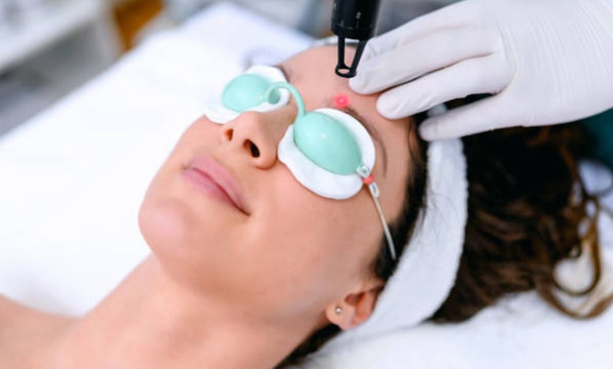 Image 10: Rejuvenecimiento facial con láser y velo de colágeno luminoso