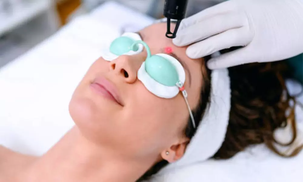 Rejuvenecimiento facial con láser y velo de colágeno luminoso