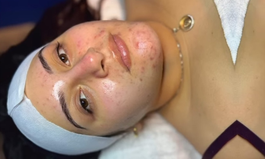 Image 8: Rejuvenate with One, Three, or Five Sessions of 60 Min Custom Facial! 