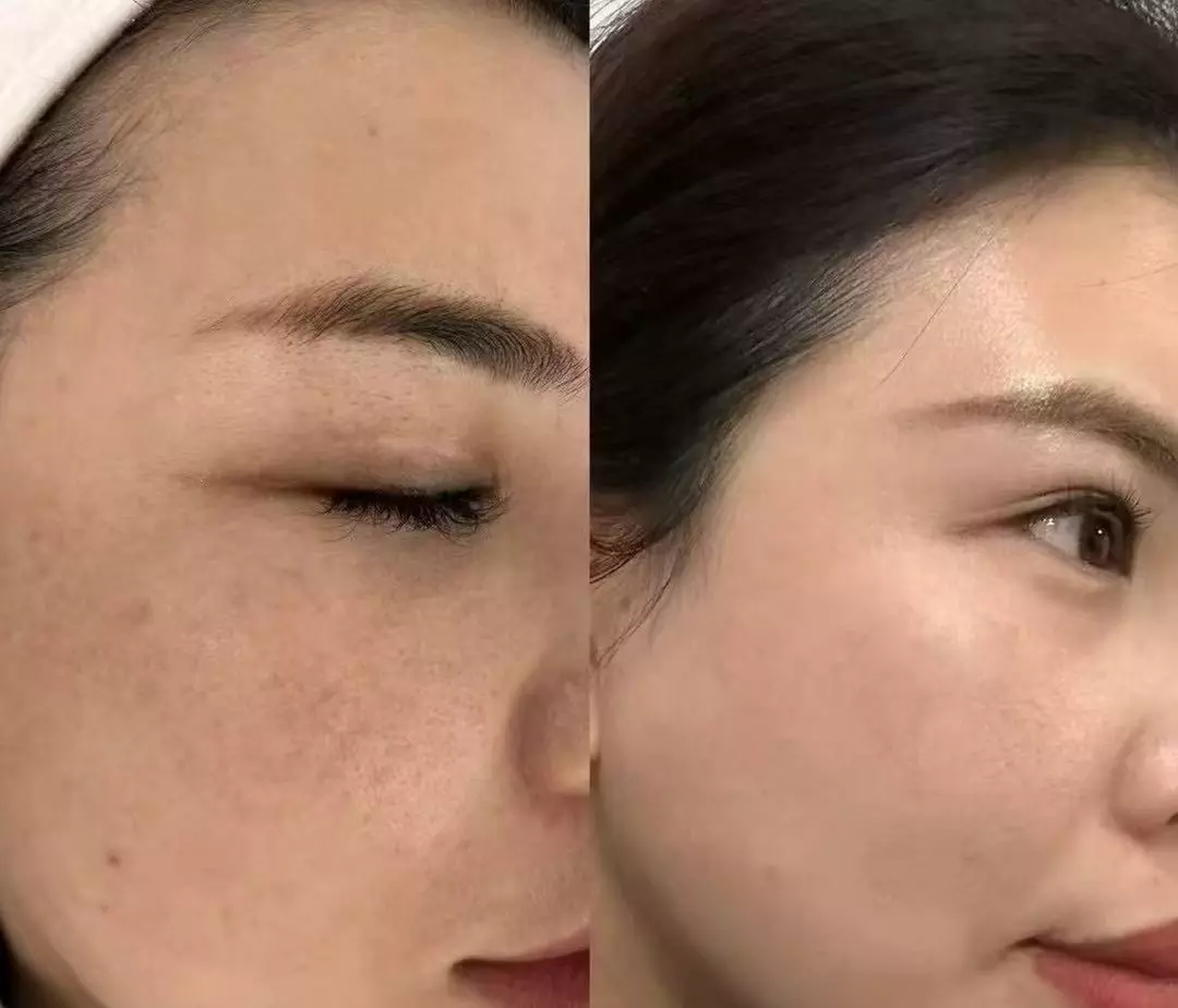 Up to 60-Min Deep Tissue Massage with 60- or 75-Min Choice of Facial 