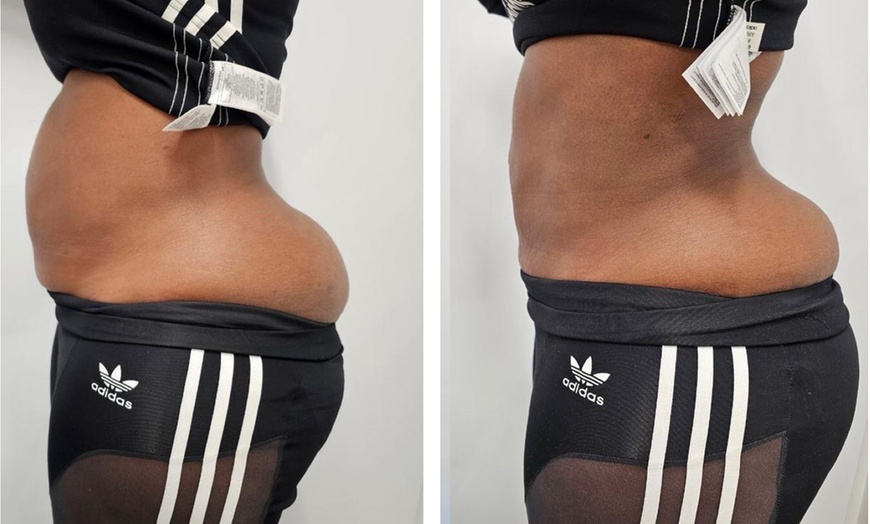 Image 6: 7 Day Juice Fast Guidance With or Without Exotic Box or 30 Day Gut Cleansing & More @Perfect Touch(Up to 54%Off)