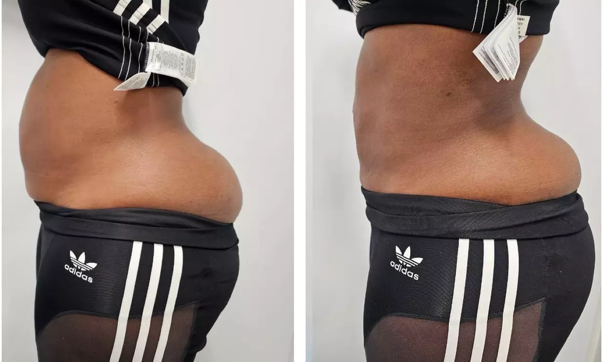 7 Day Juice Fast Guidance With or Without Exotic Box or 30 Day Gut Cleansing & More @Perfect Touch(Up to 54%Off)