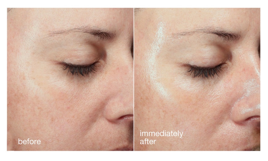 Image 3: 75-Min Advanced Dermalogica Facials: Plump, Glow, Firm & Brighten