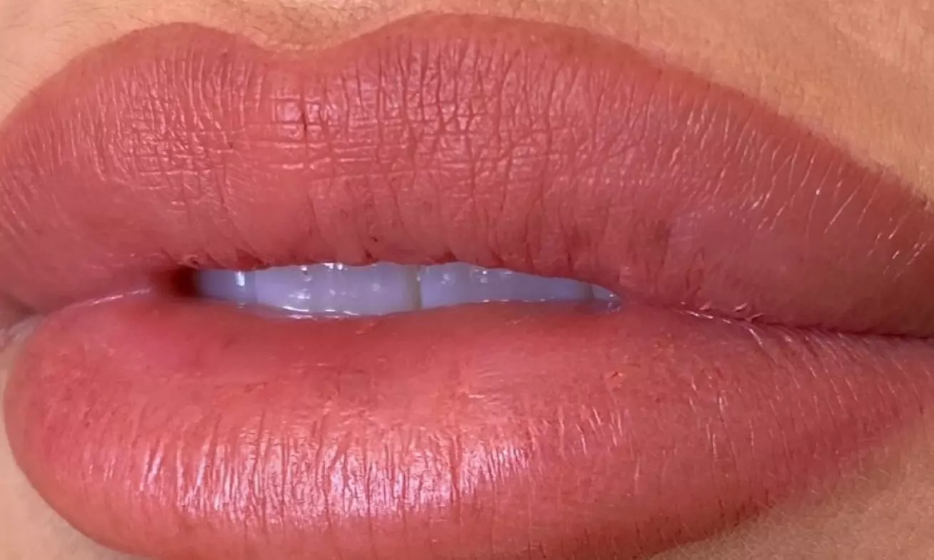  One Permanent Eyebrow, Eyeliner, Lip Blush or Saline Tattoo Removal