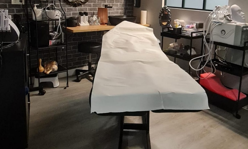 Image 4: 3 o 6 sesiones de eliminación de tatuajes de hasta 100 cm² con láser