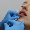 Image 3: 39% Off Smooth Lines with Juvederm Ultra XC