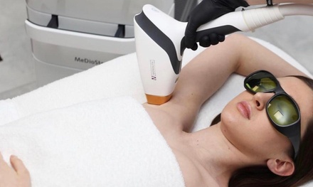 3 Behandlungen an 1 kleinen Zone nach Wahl: Haarentfernung mit Diodenlaser - Senol’s Hair & Beauty - Mannheim Friseur | Kosmetik| Laser Haarentfernung