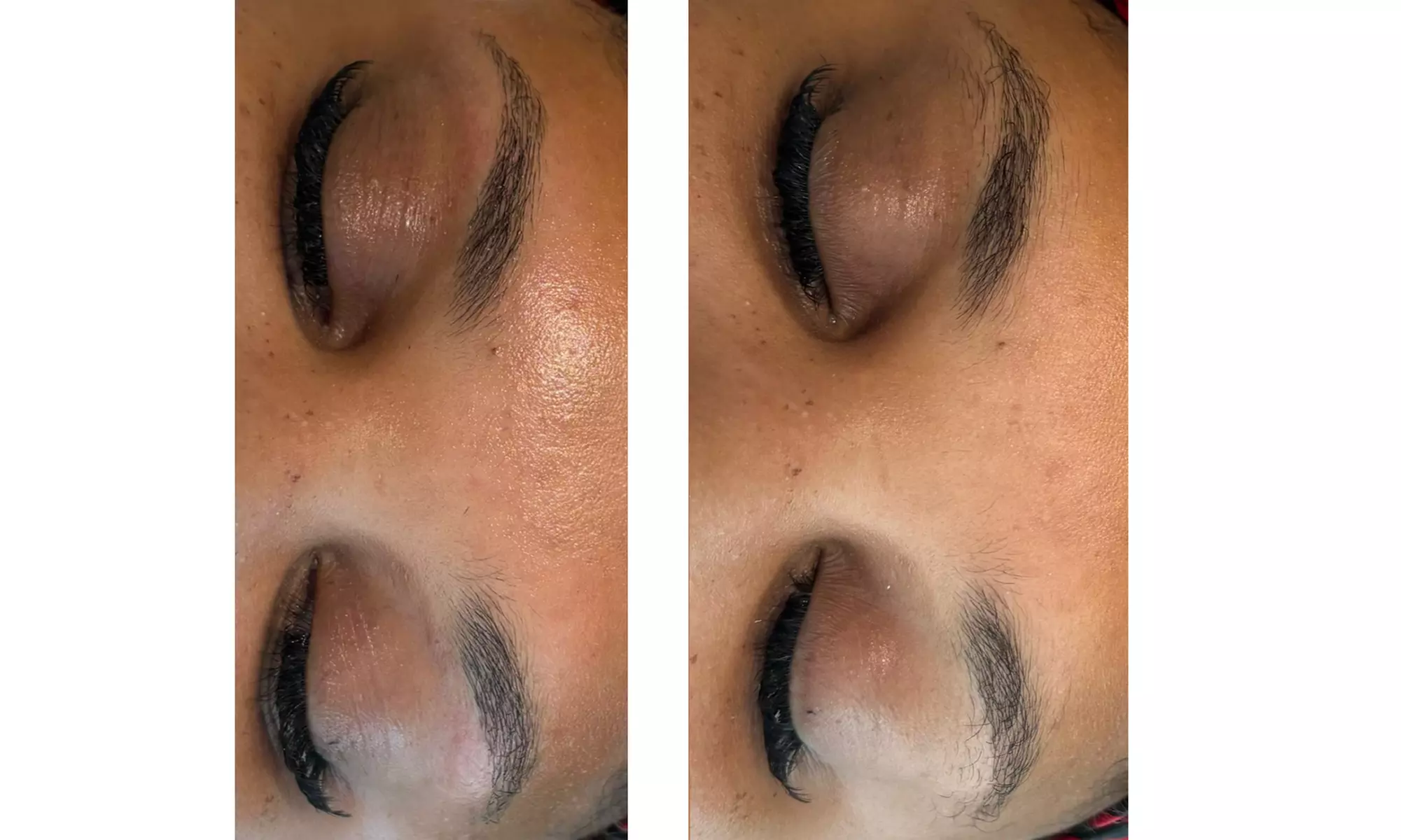 Complete Care: Brazilian, Stomach Strip, Underarms