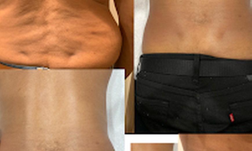 Image 6: Sculpt and Shape with Tailored Non-Invasive Contour Light Sessions
