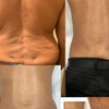 Image 6: Sculpt and Shape with Tailored Non-Invasive Contour Light Sessions