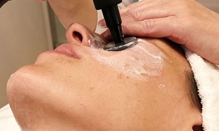 Limpieza facial express con exfoliación, tratamiento hidratante y masaje facial - Supreme Beauty Center