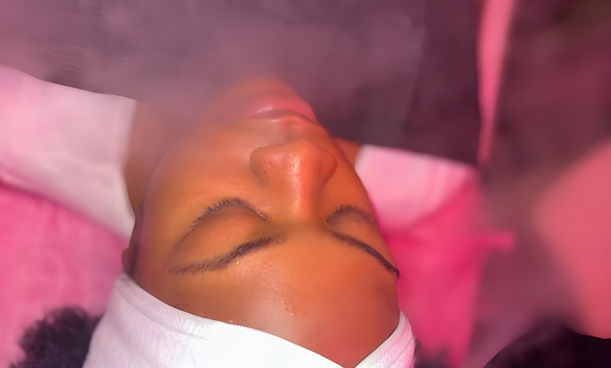 Image 3:  Maintain Youthful Skin: 20 or 40  Units of Jeuveau - 1 or 3 Sessions