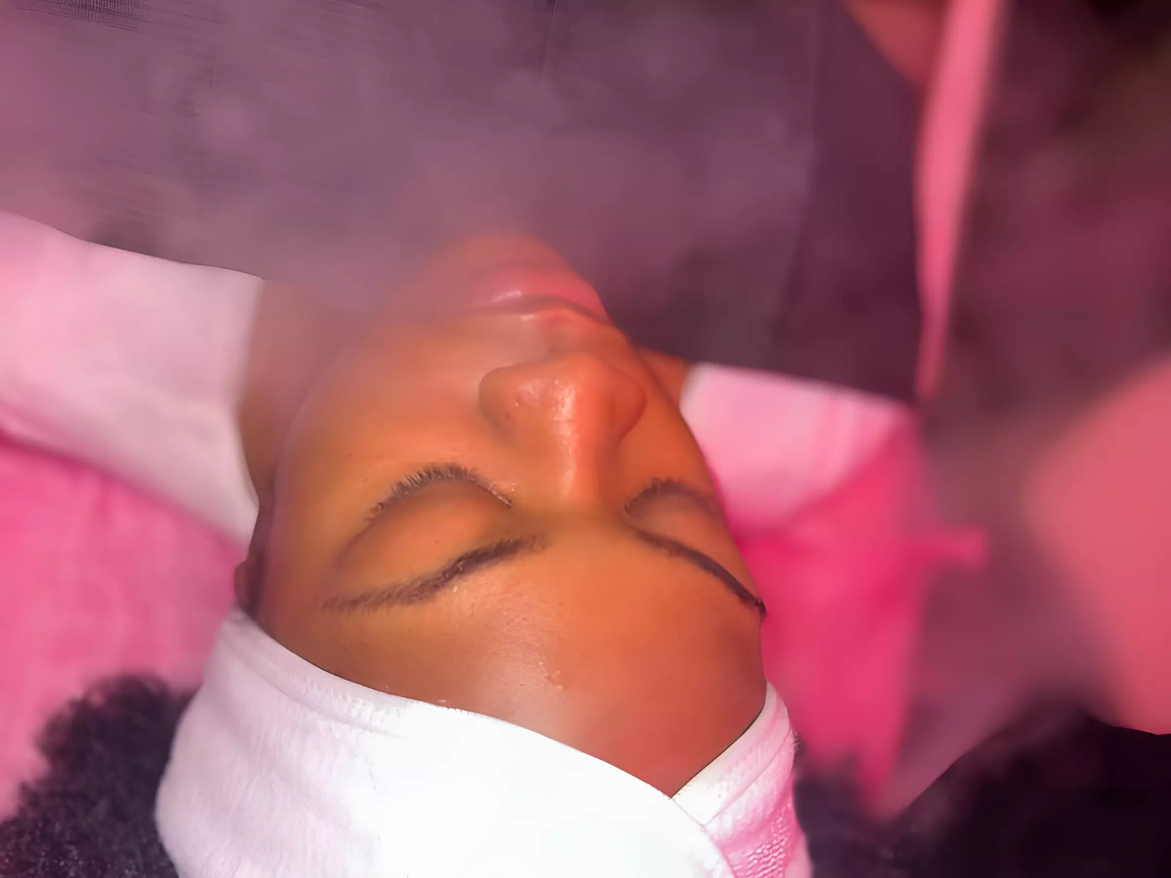  Maintain Youthful Skin: 20 or 40  Units of Jeuveau - 1 or 3 Sessions