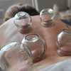 Image 1: Feel Better with One or Three Cupping Therapy Sessions