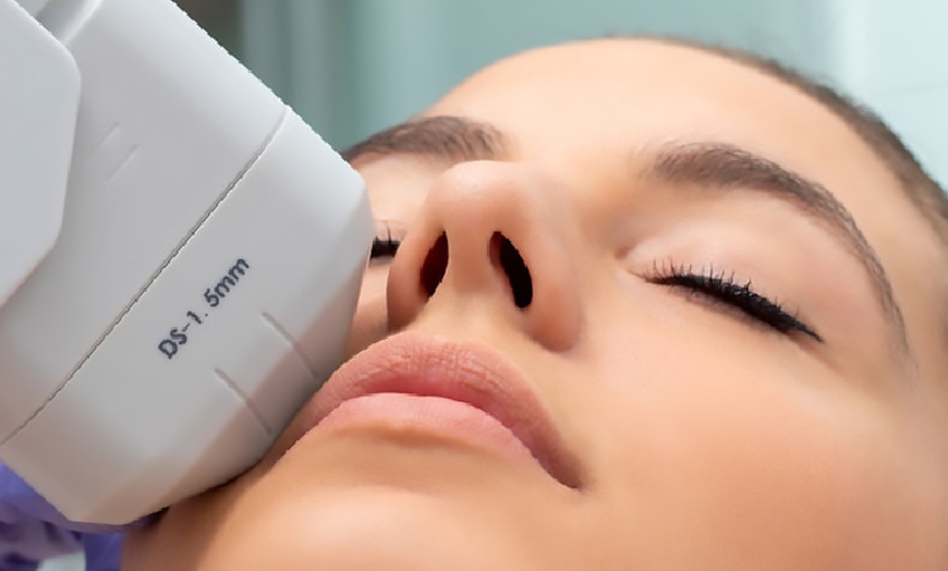 Image 2: Radio Frequency Skin Tightening for the Face with PDT Light Treatments