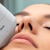 Image 2: Radio Frequency Skin Tightening for the Face with PDT Light Treatments