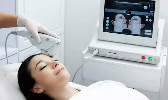 Ultherapy for Under Chin or Upper Face Including Cros Feet at  Ultherapy for Under Chin (Up to 62% Off)  - Primary Image