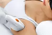 Say Goodbye to Unwanted Hair – 6 Laser Sessions for All Areas, Up To 86% Off - Second Medium