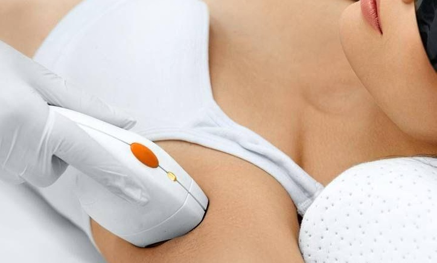 Image 6: Six Laser Hair-Removal Treatments for Every Area Size