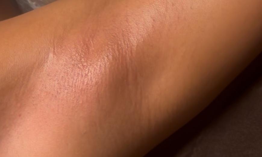 Image 4: Feel Fresh: 1, 3, 5 or 10 Brazilian/Bikini Waxing Sessions