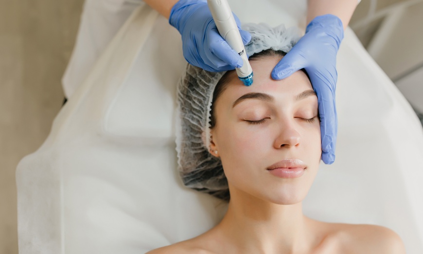 Image 11: Limpieza facial básica o profunda con opción a diferentes tratamientos