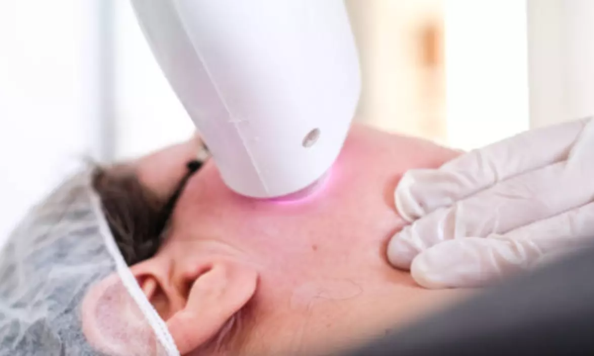 1, 3 o 6 sesiones de depilación con láser de Diodo SHR para 1 persona