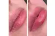 Pamper Me Pretty Day Spa Offers Hydrating Lip Drip Treatment with/without Color Boost (Up to 30% Off) - Second Medium