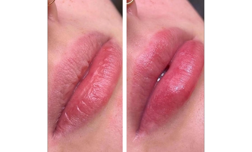 Image 4: Hydrating Lip Drip Treatment with/without Color Boost