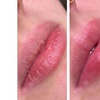 Image 4: Hydrating Lip Drip Treatment with/without Color Boost
