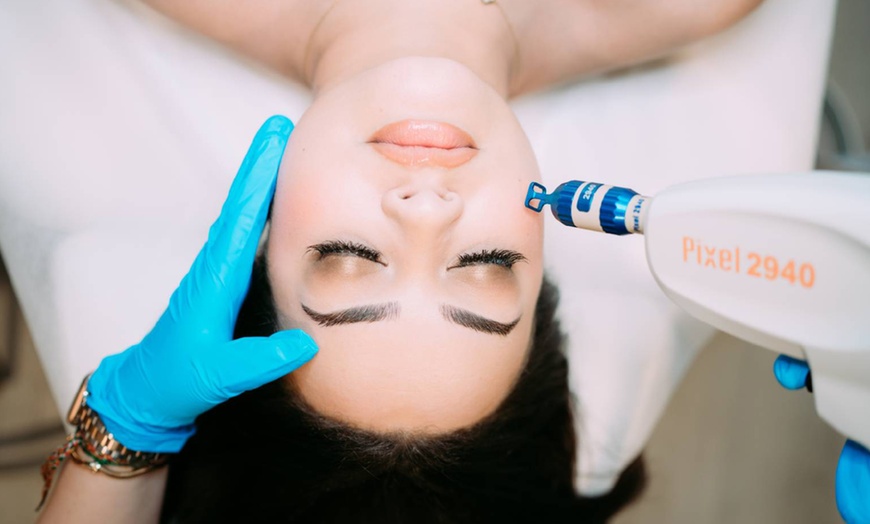 Image 2: One or Two Sessions of Face Laser Skin Resurfacing (Pixel) 