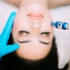 Image 2: One or Two Sessions of Face Laser Skin Resurfacing (Pixel)