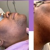 Image 1: Get Smooth Skin with Laser Hair Removal Treatments